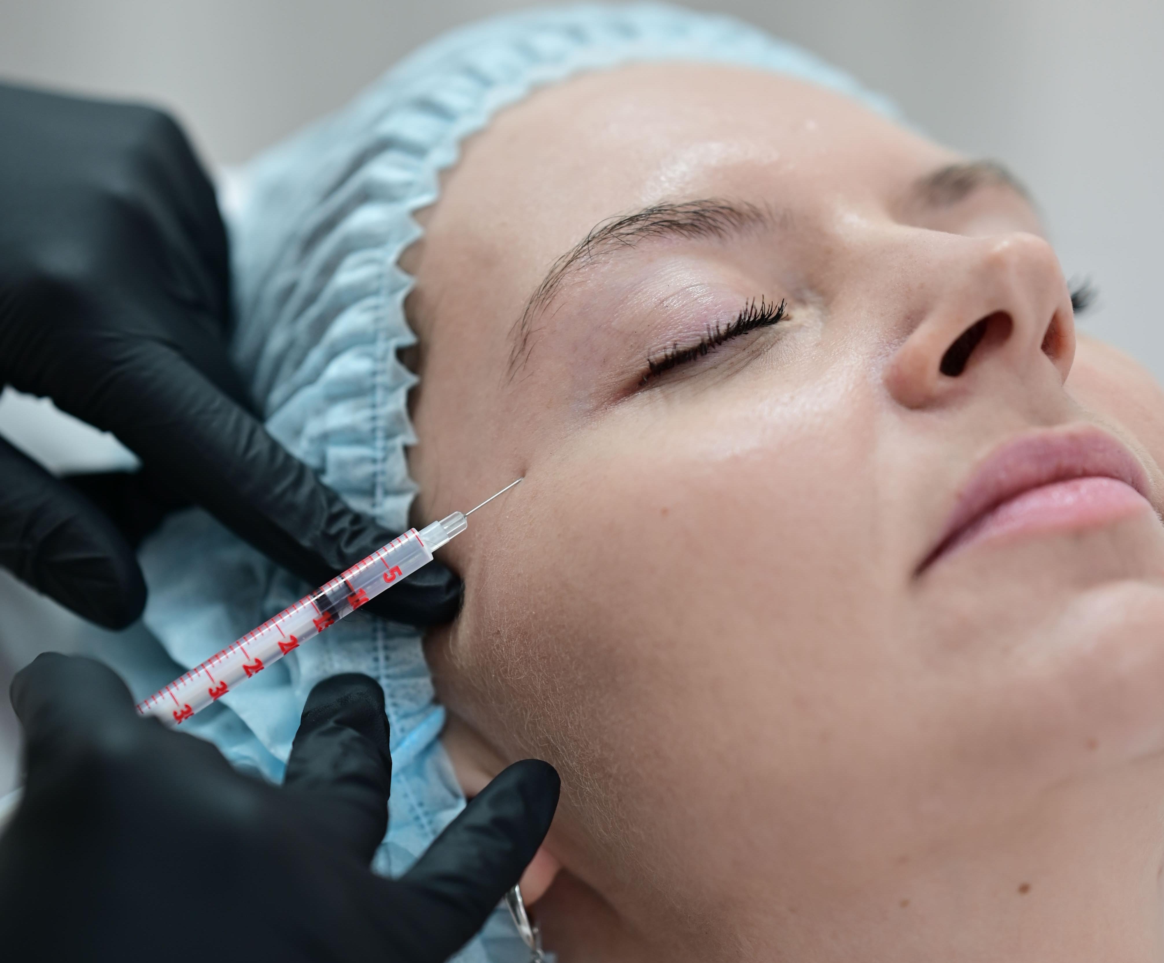 Мезотерапия зоны вокруг глаз