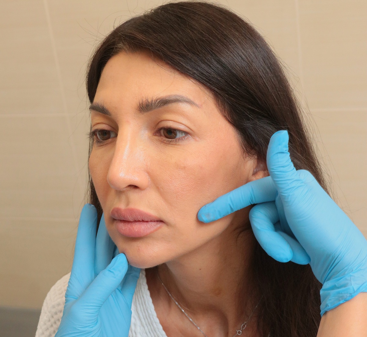 Липосакция щек