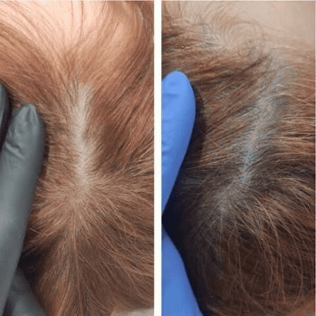 Новинка в effi: wow-возрождение кожи и лечение седины