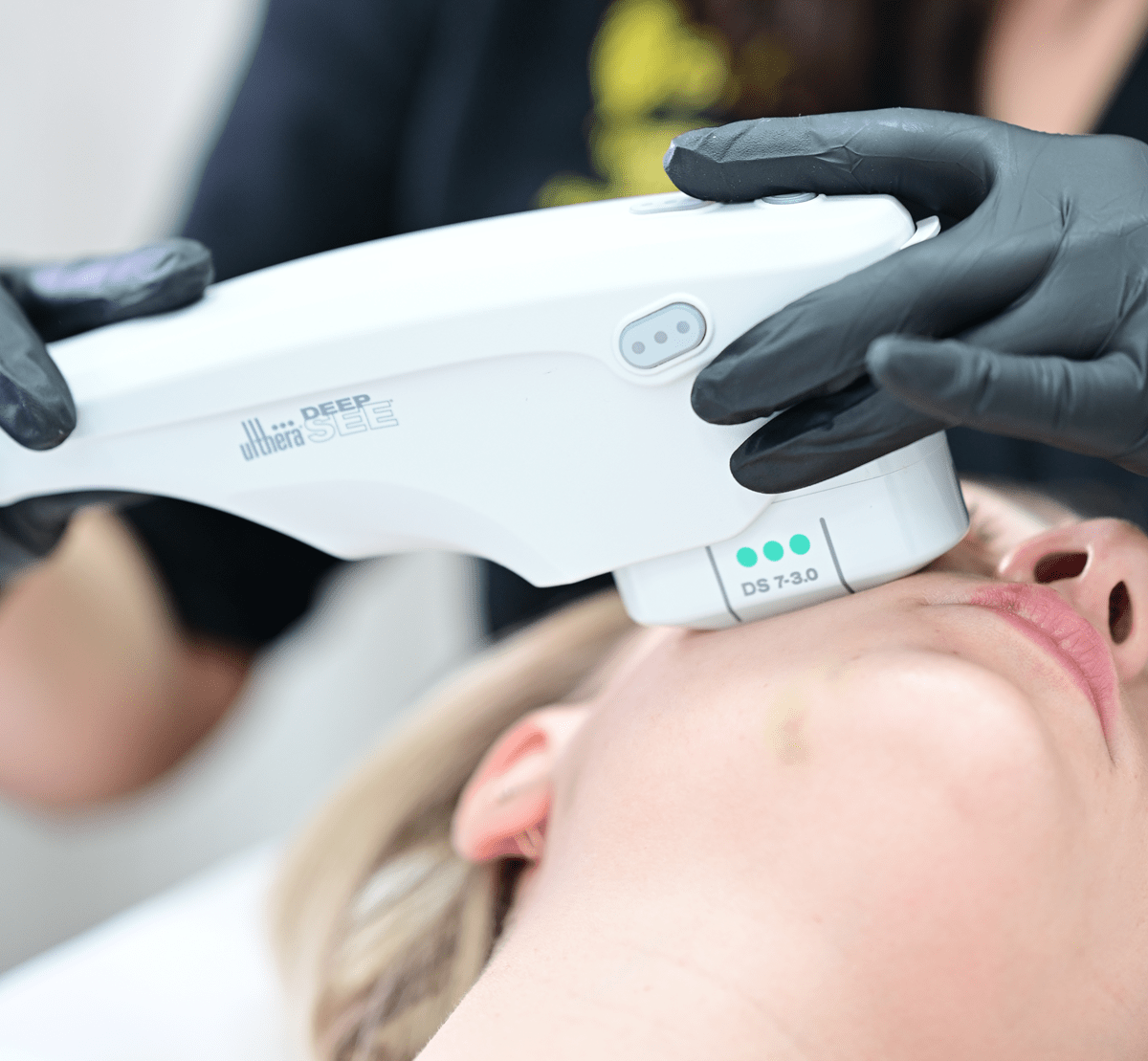 Подтяжка нижней трети лица