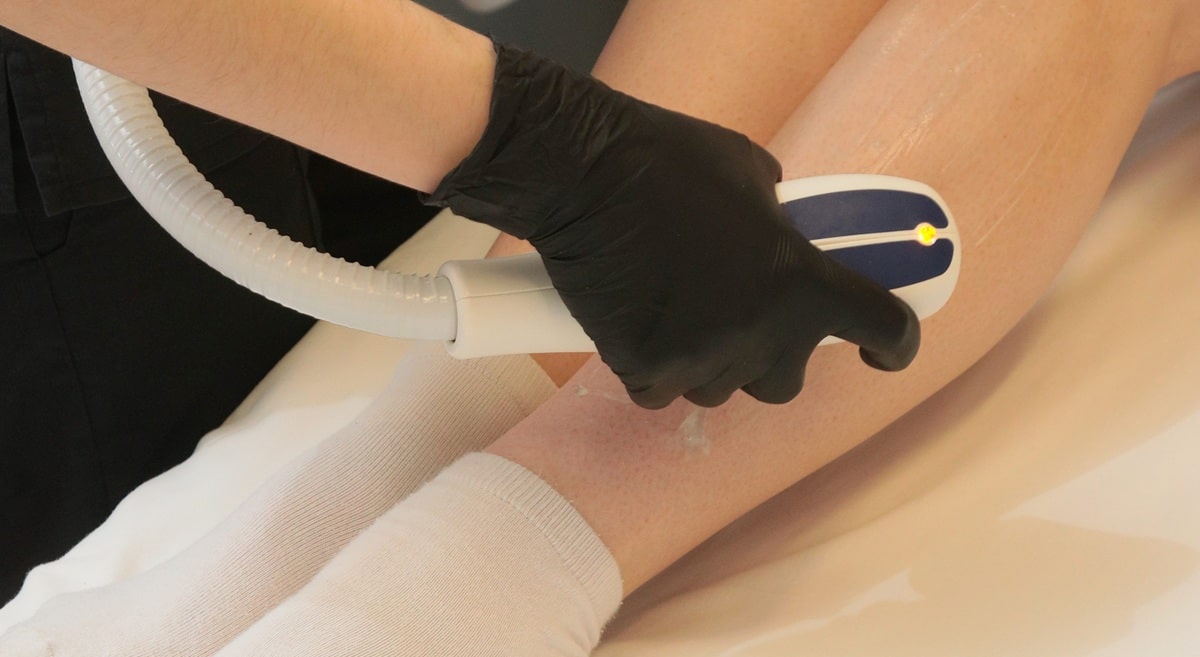 Липосакция голеней