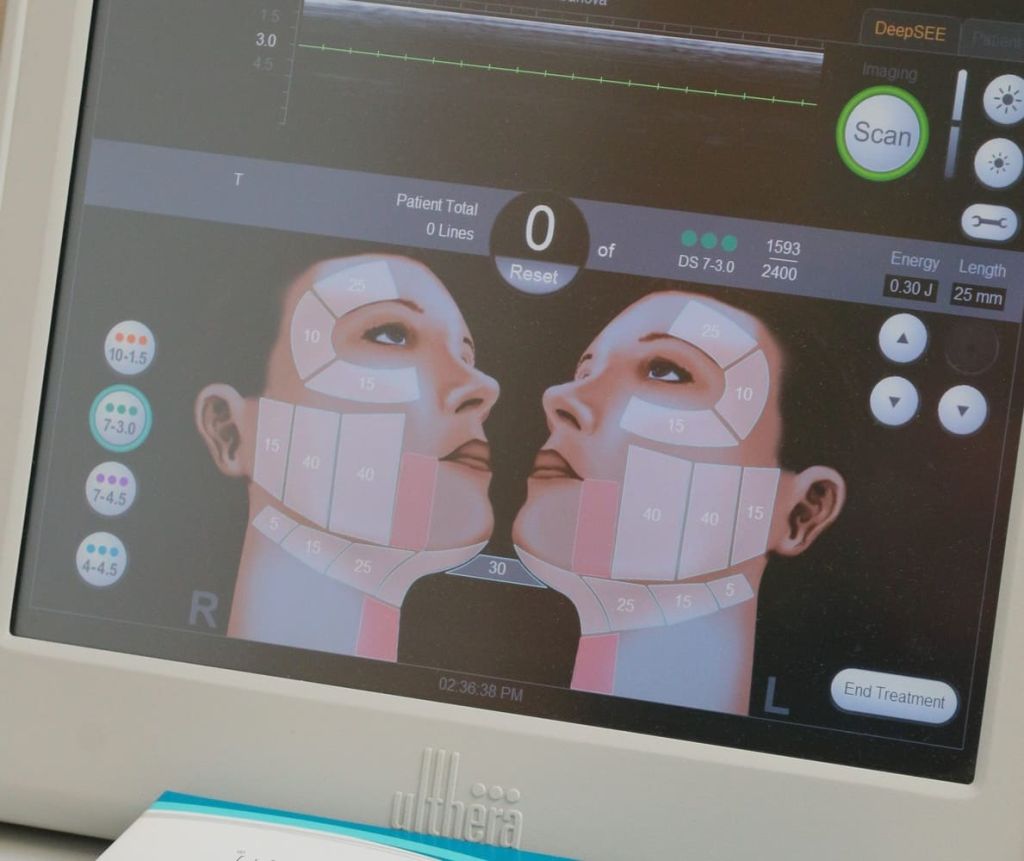 Как проходит процедура Как проходит процедура