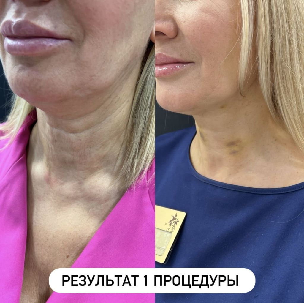 CC2CB467-94C7-48A3-944C-A6D0516ADA0D (1).jpg CC2CB467-94C7-48A3-944C-A6D0516ADA0D (1).jpg