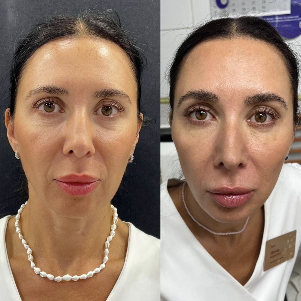 IMG_1236 (1).jpg IMG_1236 (1).jpg