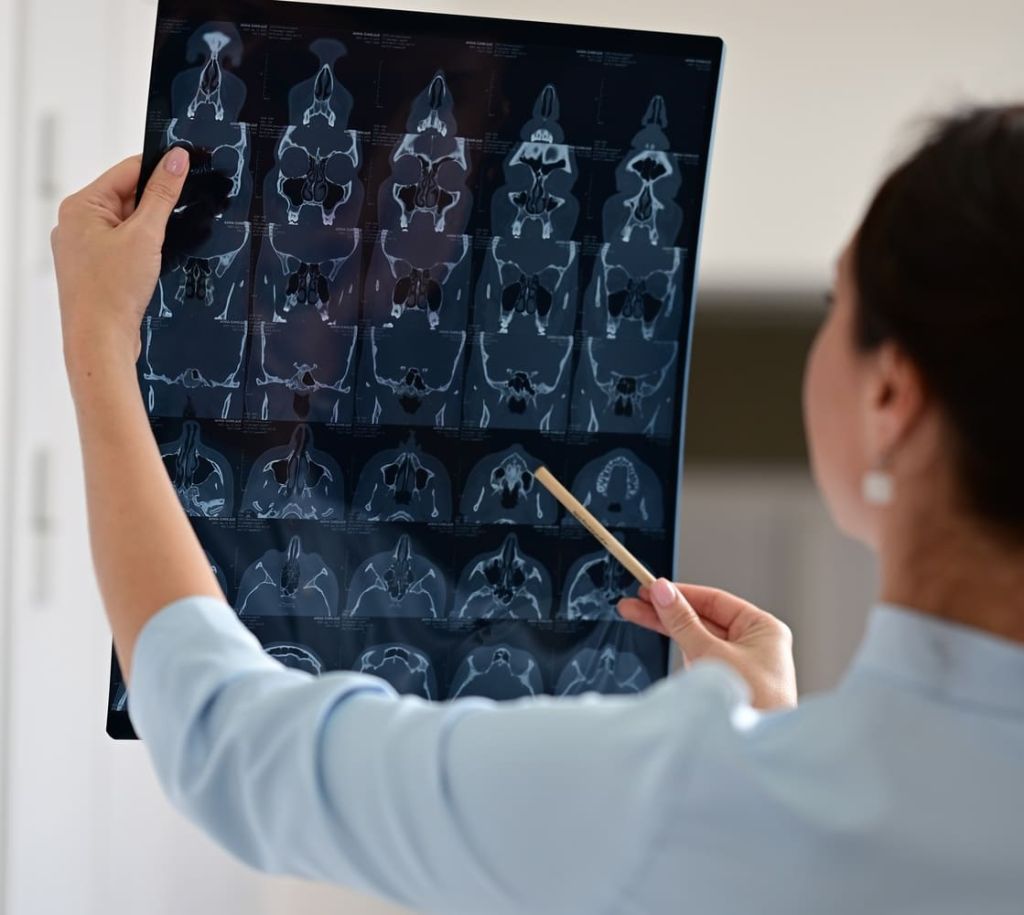 Противопоказания к проведению септопластики