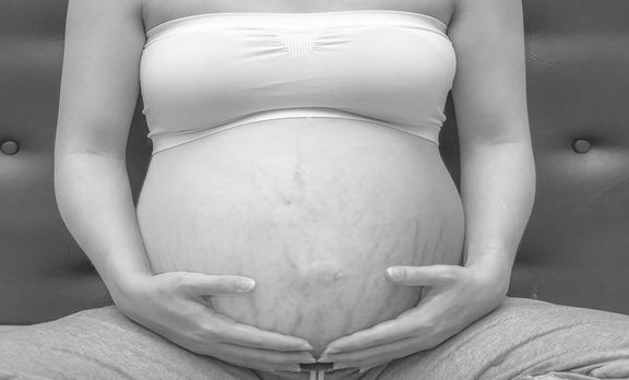 У многих женщин растяжки начинают появляться во время беременности
