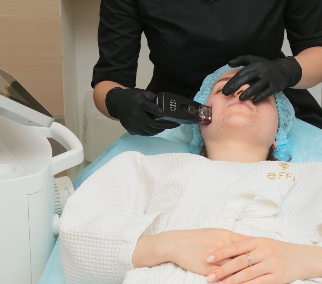 Ультразвуковой SMAS-лифтинг Ультразвуковой SMAS-лифтинг