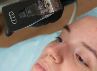 Лечение акне - инновации на страже красоты кожи