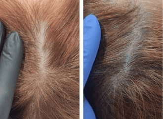 Новинка в effi: wow-возрождение кожи и лечение седины