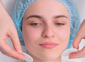 Фейслифтинг: хирургическое омоложение лица с естественным и стойким эффектом