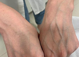 Как известно, возраст женщины выдают руки и шея