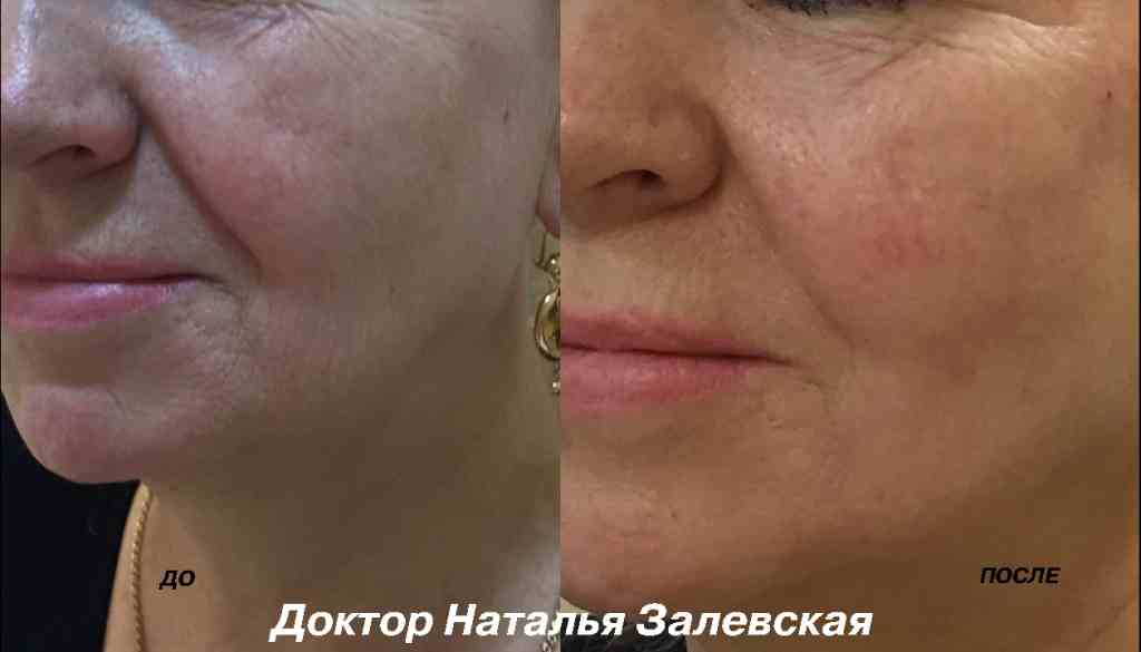yad1z1ob104fd6i72s2klgj38fi7scj3_11zon.jpg yad1z1ob104fd6i72s2klgj38fi7scj3_11zon.jpg