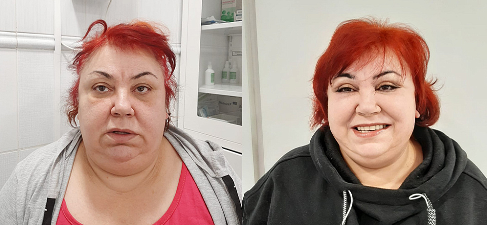 Фото до и после 